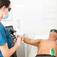 Depilación láser masculina: criterio, capas y resultados que se sostienen